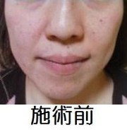 Facial & Body Beauty Service ( Beauty Heaven) 