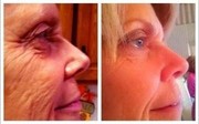  ** LUMINESCE™ cellular rejuvenation anti aging serum Relax,  Rejuvenat