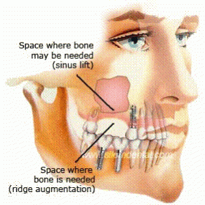 Top Oral Surgery Dentist In Australia - Ballarat Dental Care