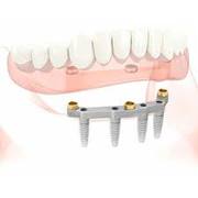 Denture Clinic Essendon